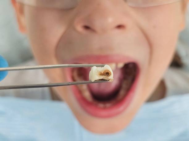 Best Same-Day Emergency Dentist in Ritzville, WA