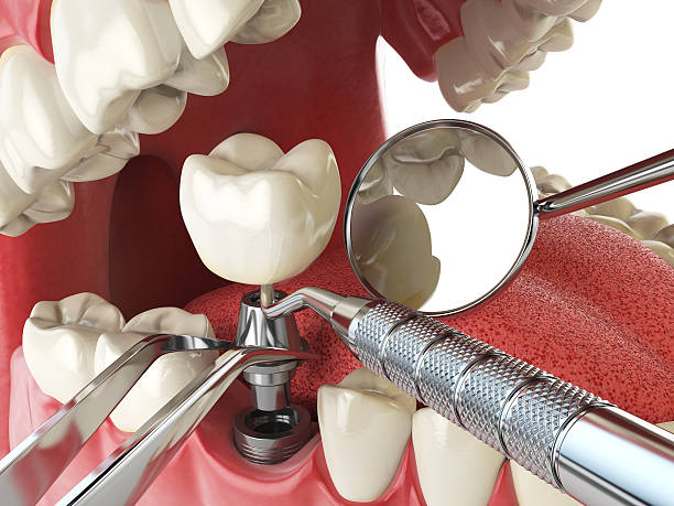Best Emergency Dental Care for Trauma or Injury in Ritzville, WA